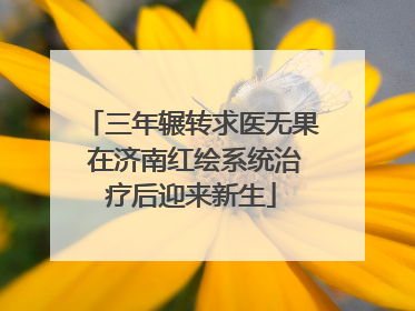 三年辗转求医无果 在济南红绘系统治疗后迎来新生